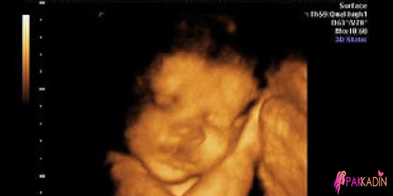 Gebeliğin 27.haftasında ultrason görüntüleri