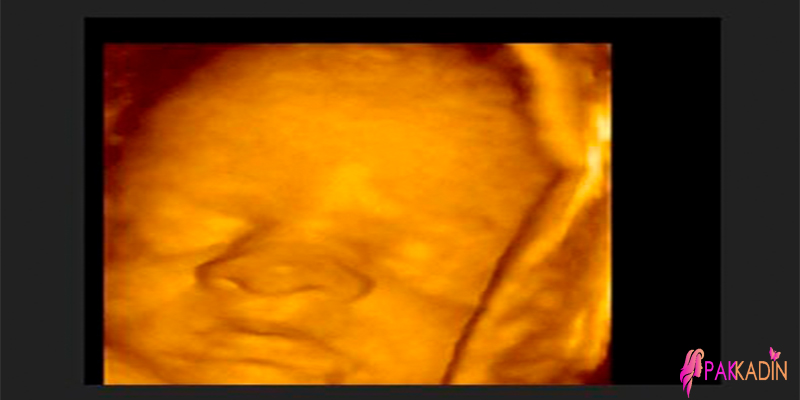 29. Hafta Gebelik Ultrason Görüntüleri